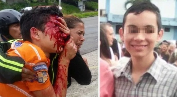 Ragazzino di 16 anni viene colpito dalla polizia durante la manifestazione. «Ha perso entrambi gli occhi»