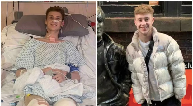 Calciatore in ospedale per polmonite, i medici gli amputano entrambe le gambe: «Era l'unico modo per salvarlo»
