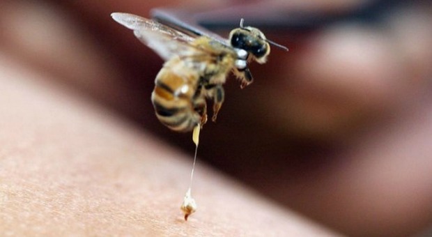 Punto da un'ape nel giardino di papà: Filippo è in coma da giovedì