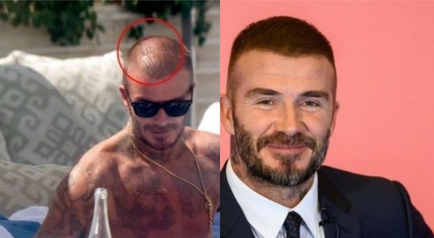 David Beckham, allerta calvizie? Pochi giorni dopo i capelli sono più folti