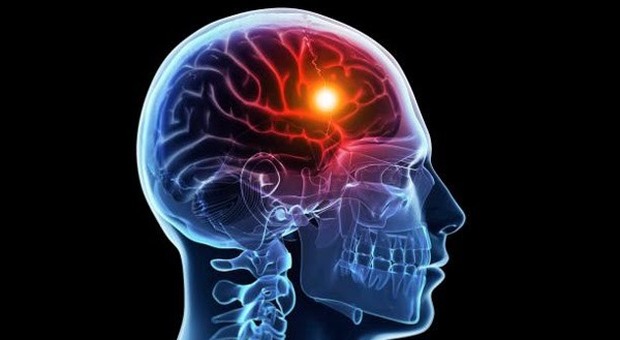 Ictus, scoperto dispositivo che media la memoria: potrebbe prevenire amnesie e riattivare ricordi
