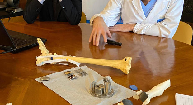Caviglia ricostruita con una protesi in 3D: la prima volta al mondo al Rizzoli di Bologna