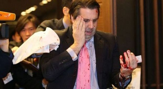 Corea del Sud, l'ambasciatore degli Stati Uniti ferito al volto con un rasoio. "Coree unite"