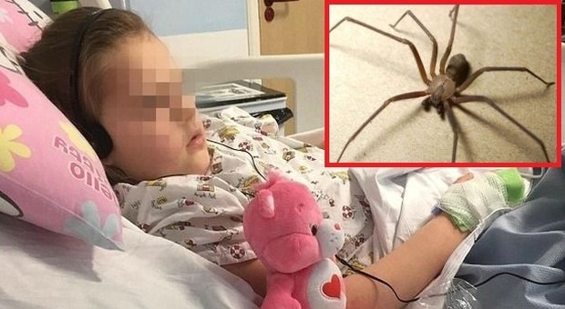 Allarme ragno eremita marrone, tra i più letali: bimbe morse finiscono all'ospedale -Guarda