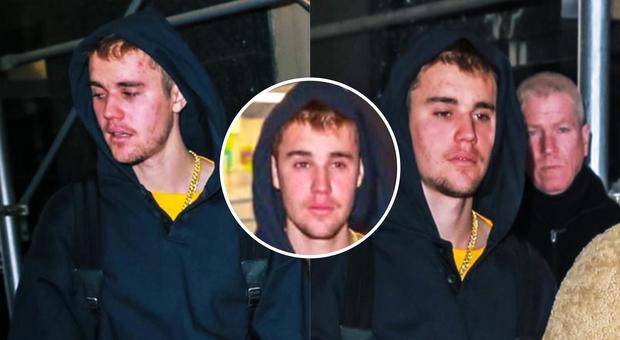 Justin Bieber e la depressione, fan preoccupati e furiosi coi paparazzi