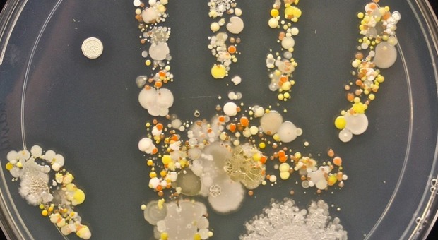 California, foto sconvolgente mostra tutti i batteri sulla mano di un bambino di otto anni