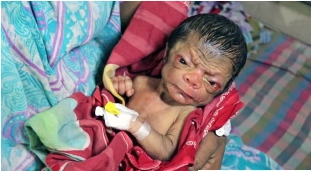 Il neonato come "Benjamin Button": appena nato ma sembra un ottantenne