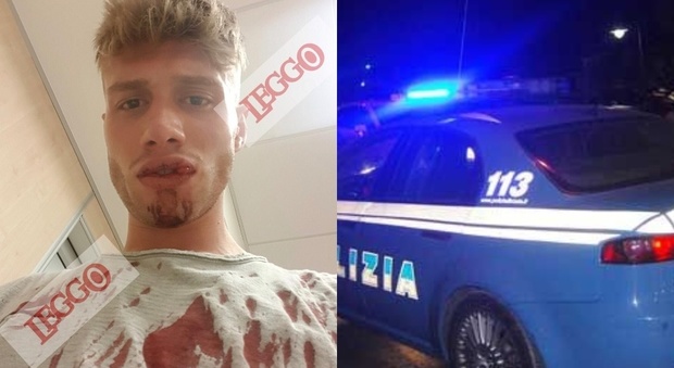 Roma, denuncia choc del 23enne Marco: «Fermato e picchiato a sangue da un poliziotto in borghese»