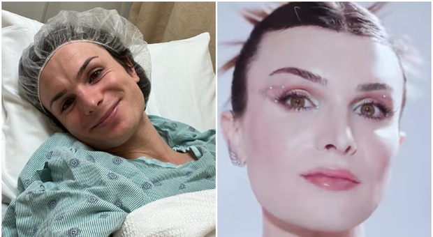 Tiktoker transgender cambia volto (grazie alla chirurgia), il risultato è sorprendente: «Mi ha cambiato la vita»