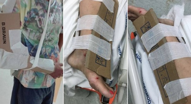 Cartoni usati come gessi per immobilizzare le fratture, il primario: «Il paziente era arrivato così e l'abbiamo tenuto per evitare complicazioni»