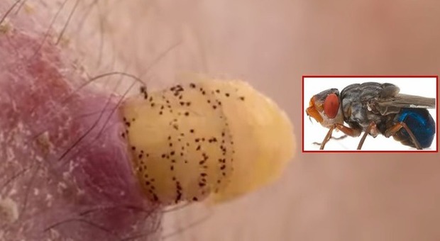 Scopre una larva nel suo braccio: la estrae e la inserisce di nuovo per studiarla