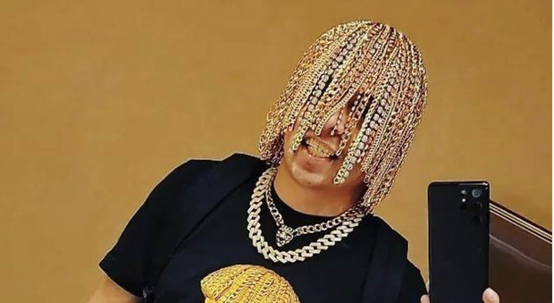 Dan Sur, il rapper si fa impiantare catene d'oro e diamanti al posto dei capelli: «Adesso non può copiarmi nessuno»