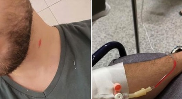Roma, studente bocciato all'Itis: il papà picchia a sangue il giovane prof 23enne Foto choc