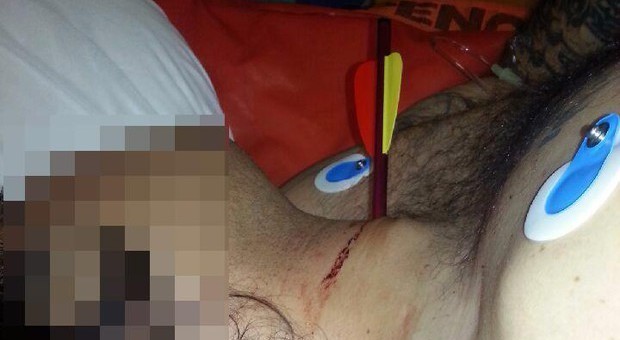 Un dardo della balestra gli trapassa il collo: salvato da uno straordinario intervento a Torino
