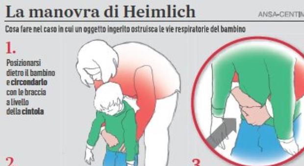 Cos'è la manovra di Heimlich: le mosse che possono salvare la vita