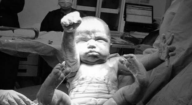 Il bimbo nasce con la posa da Superman: la foto del piccolo fa il giro del mondo