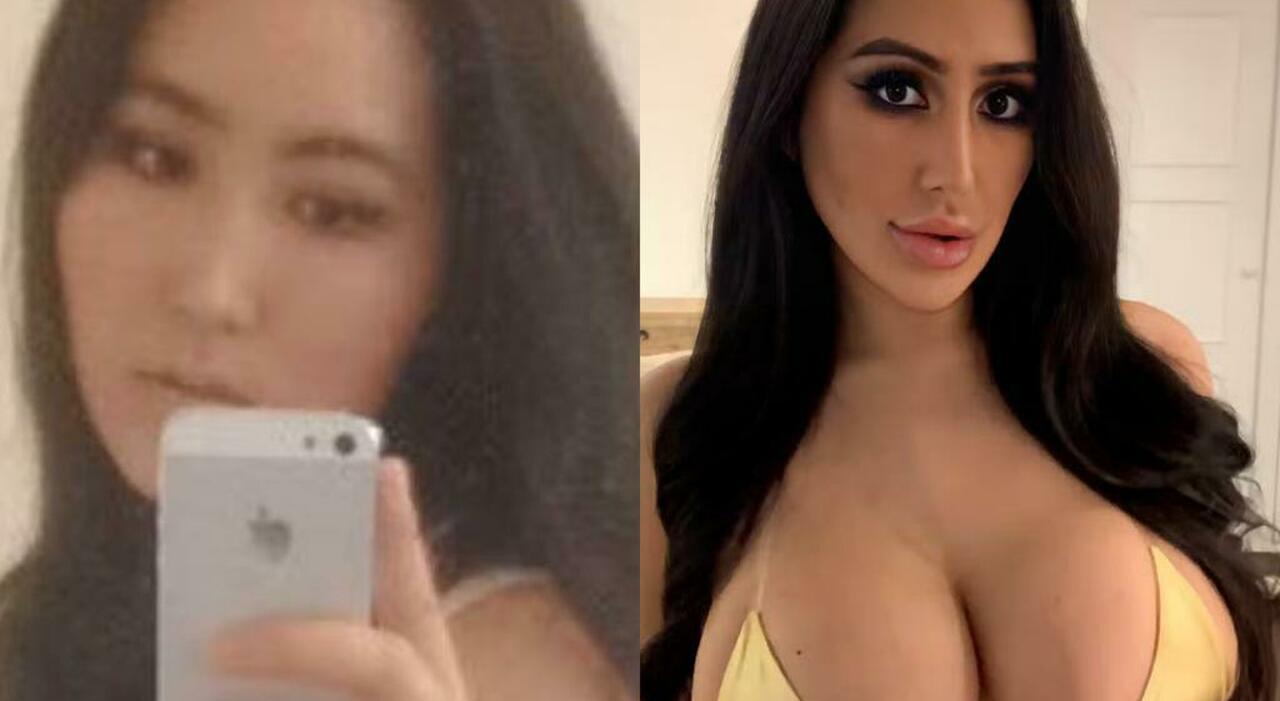 «Voglio essere uguale a Kim Kardashian», la pazzia della ragazza sudcoreana: ha speso 60mila euro in chirurgia