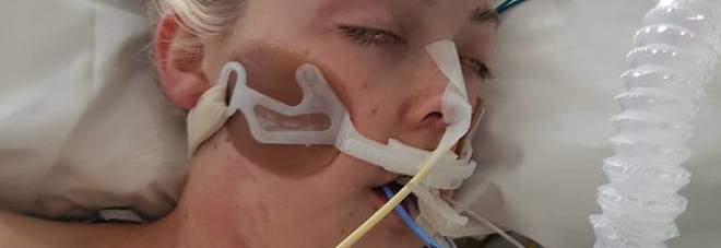 Â«Ecco come l'ha ridotta la drogaÂ», la foto choc della sorella di una 24enne morta per overdose