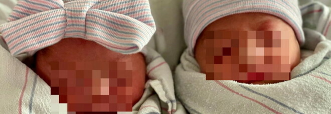 Usa, gemelli con giorni, mesi e anni diversi: nati a 15 minuti di distanza. Uno nel 2021, l'altra nel 2022