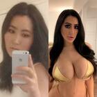 «Voglio essere uguale a Kim Kardashian», la pazzia della ragazza sudcoreana: ha speso 60mila euro in chirurgia