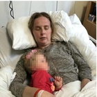 Vertigini e herpes, mamma di 33 anni pensa di soffrire di "baby brain" ma riceve la diagnosi choc: «Morta in 6 mesi»