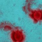 Misteriosa minaccia dal Brasile, cos'è lo Yaravirus? "90% dei geni sconosciuti"