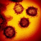 Coronavirus, ecco la prima foto a colori: «Molto simile alla Sars»