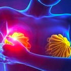 Tumore al seno, scoperto un farmaco «rivoluzionario» che riduce le metastasi e blocca l'avanzamento della malattia