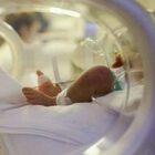 Virus sinciziale, allarme neonati: record infezioni al Meyer di Firenze, 140 casi da inizio anno