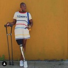 Morta Mama Cax, la modella che a 14 anni perse una gamba per un tumore: l'ultimo messaggio su Instagram