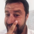 Salvini ha l'orzaiolo: «Lo curo con i rimedi della nonna». La replica di Burioni: «Guarisce da solo»