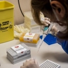 L'esperimento: 90 volontari contagiati per capire quanto virus serve per infettare