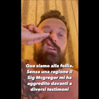 Facchinetti su Instagram: «Picchiato da Conor McGregor». Il suo racconto nelle stories VIDEO