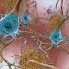 Alzheimer, il vaccino che "ripristina la memoria" (e costa 18 euro): test positivi sui topi