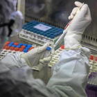 Clorochina, uno studio su Lancet: «Aumenta il rischio di mortalità per coronavirus»