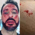 Fabrizio Corona revocati i domiciliari: lui si taglia i polsi, poi spacca il vetro dell'ambulanza e va fuori di sé con la polizia: «Andate via»