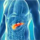 Tumore al pancreas, nuova cura americana 