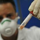 Coronavirus, altri 241 contagi in Abruzzo. Pescara ancora in emergenza