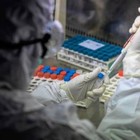 Coronavirus, Aifa: giovedì via ai test farmaco anti-artrite su 330 pazienti