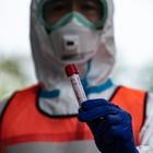 Germania studia la soluzione: vaccino anti-Tbc attivo anche contro il Covid?
