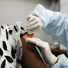 Marburg, il virus fa paura: «Ha l'88% di mortalità». Corsa contro il tempo per testare i primi vaccini