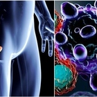 Tumore alla prostata, svelato il meccanismo che lo favorisce: ecco le cellule attraverso le quali si sviluppa la malattia