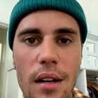 Justin Bieber choc, su Instagram sconvolge i fan: «Ho una paralisi al volto, non posso cantare»