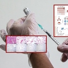 Il super vaccino a nanoparticelle