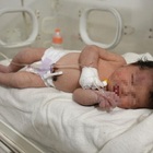 Terremoto Turchia e Siria, bimba salvata dopo 40 ore. Neonata data alla luce sotto le macerie