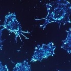 Tumori, l'oncologo Curigliano: «Ora possibile piccola pandemia a causa del Covid19»