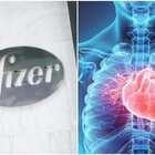 Effetti collaterali Pfizer, cos'è la miocardite e quando si può verificare: quali sintomi controllare
