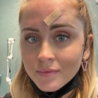 Valentina Ferragni operata al viso: «Potrebbe essere una cisti o un tumore maligno»