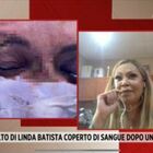 Linda Batista a Storie Italiane: «Colpita in faccia col tacco di una scarpa». Il suo volto coperto di sangue