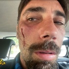 Striscia La Notizia, Vittorio Brumotti preso a pugni dai pusher di Foggia: «Non mi fermo»